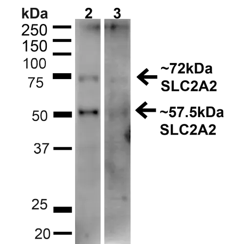 WB analysis of HeLa (lane 2) and 293T (lane 3) cell lysates using GTX02544 GLUT2 antibody. Dilution : 1:1000 Loading : 20 microg