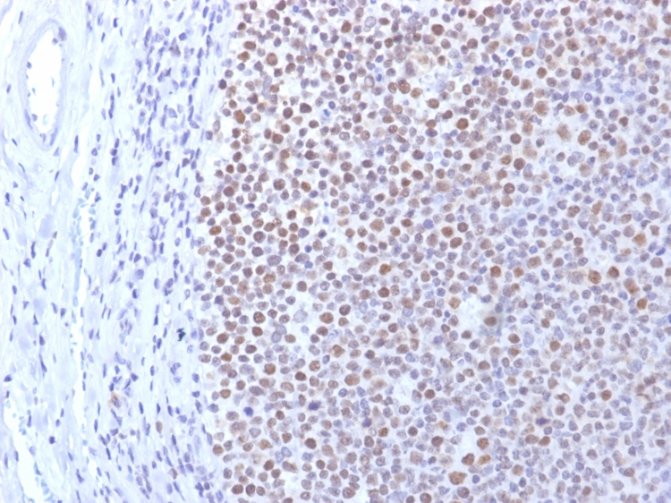 IHC-P anaylsis of human tonsil tissue using GTX02546 DNMT1 antibody [DNMT1/2061].