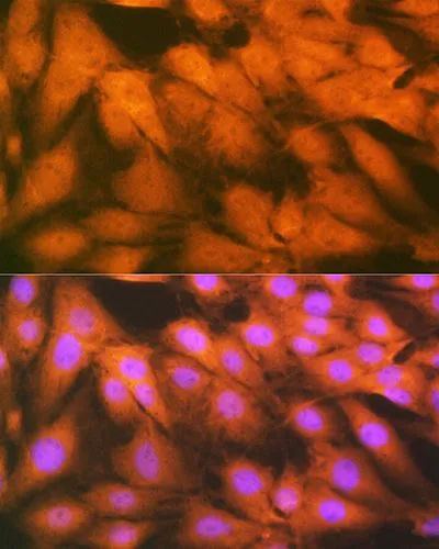 ICC/IF analysis of U2OS cells using GTX02554 FGF1 antibody [GT1220].<br>Orange : Primary antibody<br>Blue: DAPI for nuclear staining<br>Dilution : 1:100
