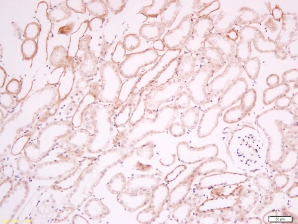 IHC-P analysis of mouse kidney tissue using GTX02560 CD34 antibody.<br>Antigen retrieval : Boiling in sodium citrate buffer (pH6) for 15min<br>Dilution : 1:200