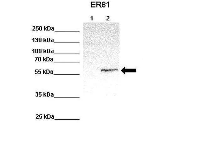 WB analysis of ER81-transfected HEK293 cell lysate using GTX02562 ER81 antibody. Lane 1 : 100 microg untransfected HEK293 lysate Lane 2 : 33 microg ER81 transfected HEK293 lysate Dilution : 1:1000