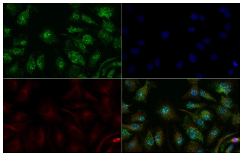 ICC/IF analysis of 4% PFA-fixed HepG2 cells using GTX02576 ADFP Antibody.<br>Green : Primary antibody<br>Red : Alpha tubulin (DM1A)<br>Blue : Nuclei were counterstained with DAPI<br>Permeabilization : 1X TBS + 0.5% Triton-X100<br>Dilution : 1:100