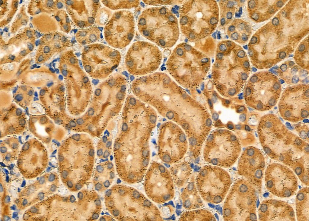 IHC-P analysis of rat kidney tissue using GTX02577 NOX1 antibody.<br>Antigen retireval : heat mediated antigen retrieval step in citrate buffer was performed<br>Dilution : 1:100