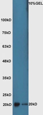 WB analysis of various lysates using GTX02578 ATF3 antibody. Lane 1 : mouse lung tissue lysate Lane 2 : mouse brain tissue lysate