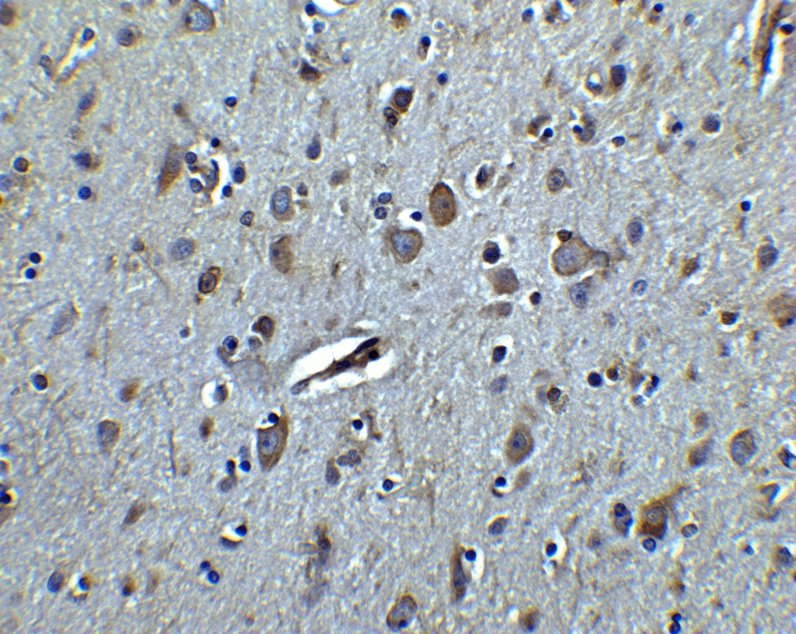 IHC-P analysis of human brain tissue using GTX02579 TET3 antibody. Dilution : 2.5 microg/ml
