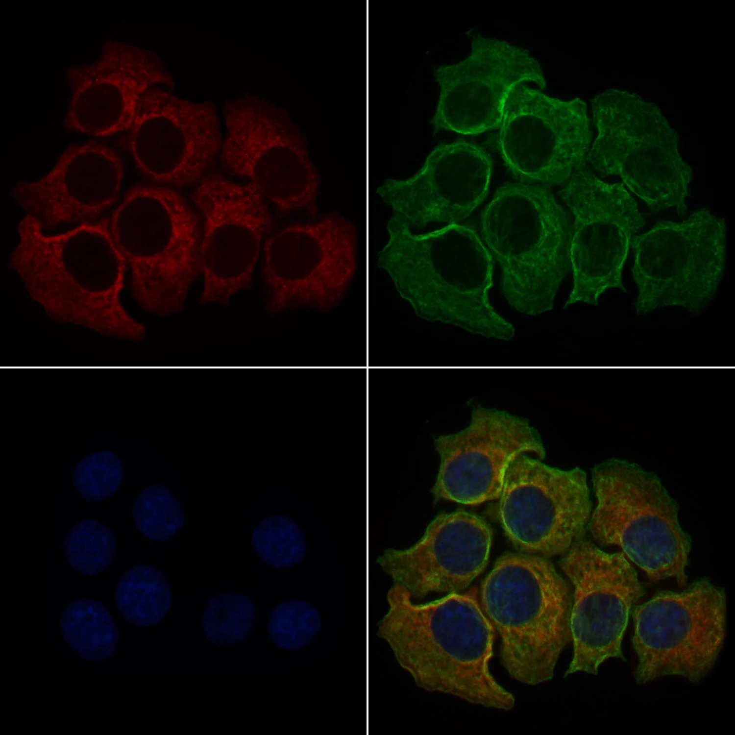 ICC/IF analysis of PFA-fixed HeLa cells using GTX02580 PLCE1 antibody. Red : Primary antibody Green : beta tubulin Blue : DAPI Permeabilization : 0.1% Triton X-100 Dilution : 1:200
