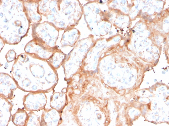 IHC-P analysis of human placenta tissue section using GTX02594 Aurora B antibody [rAURKB/1592].
