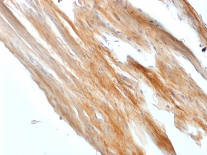 IHC-P analysis of rat uterus tissue section using GTX02598 Caldesmon antibody [CALD1/1424R].