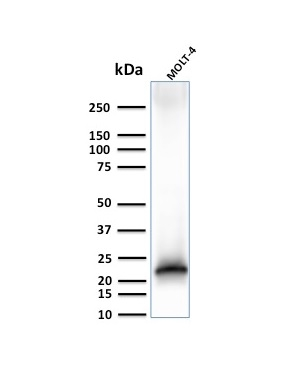 WB analysis of MOLT-4 whole cell lysate using GTX02605 CD3 epsilon antibody [C3e/3125R].
