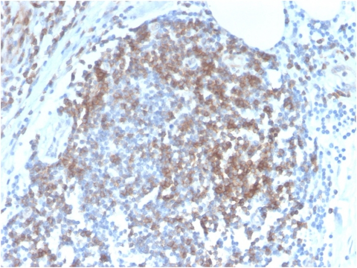 IHC-P analysis of human tonsil tissue section using GTX02609 CD6 antibody [C6/2884R].