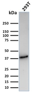 WB analysis of 293T whole cell lysate using GTX02612 CD74 antibody [CLIP/3127R].