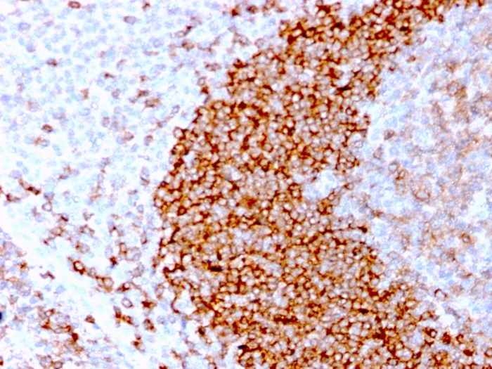 IHC-P analysis of human tonsil tissue section using GTX02613 CD79b antibody [IGB/3170R].
