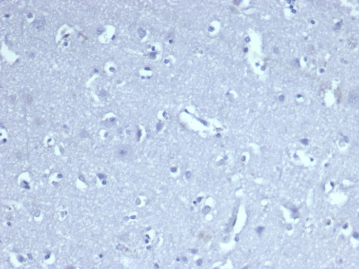 IHC-P analysis of human tonsil tissue section using GTX02616 CD8 alpha antibody [CD8/4391R].