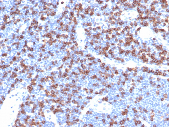 Analysis of Protein Array containing more than 19,000 full-length human proteins using CD8a Recombinant Rabbit Monoclonal Antibody (CD8/4391R). Z- and S- Score: The Z-score represents the strength of a signal that a monoclonal antibody (MAb) (in combination with a fluorescently-tagged anti-IgG secondary antibody) produces when binding to a particular protein on the HuProtTM array. Z-scores are described in units of standard deviations (SDs) above the mean value of all signals generated on that array. If targets on HuProtTM are arranged in descending order of the Z-score, the S-score is the difference (also in units of SDs) between the Z-score. S-score therefore represents the relative target specificity of a MAb to its intended target. A MAb is considered to specific to its intended target, if the MAb has an S-score of at least 2.5. For example, if a MAb binds to protein X with a Z-score of 43 and to protein Y with a Z-score of 14, then the S-score for the binding of that MAb to protein X is equal to 29.
