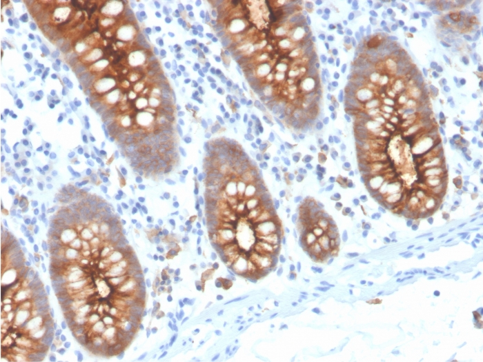 IHC-P analysis of human colon tissue section using GTX02620 CD66e antibody [C66/3707R].