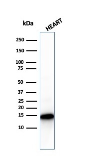 WB analysis of human heart tissue lysate using GTX02626 Cytochrome C antibody [CYCS/3128R].