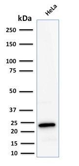 WB analysis of HeLa whole cell lysate using GTX02641 Ferritin Light Chain antibody [FTL/2338R].