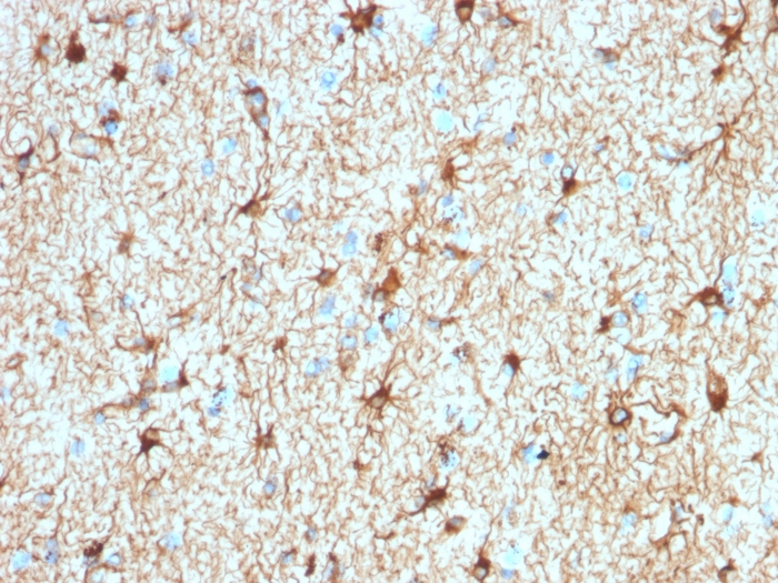 IHC-P analysis of human cerebellum tissue section using GTX02644 GFAP antibody [ASTRO/1974R].