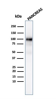 WB analysis of human pancreas tissue lysate using GTX02646 GP2 antibody [GP2/3134R].