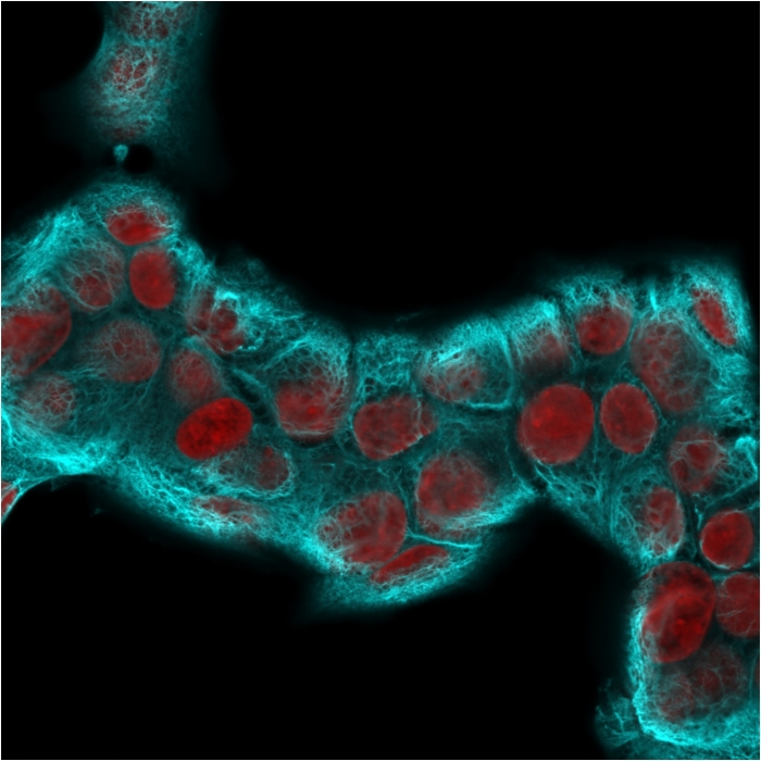 ICC/IF analysis of MCF-7 cells using GTX02658 Cytokeratin 18 antibody [KRT18/2819R]. Blue : Primary antibody Red : nuclear counterstain