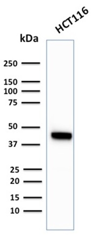 WB analysis of HCT116 whole cell lysate using GTX02658 Cytokeratin 18 antibody [KRT18/2819R].