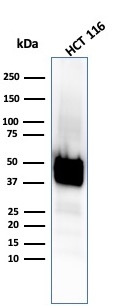WB analysis of HCT116 whole cell lysate using GTX02668 Cytokeratin 8 antibody [KRT8/4067R].