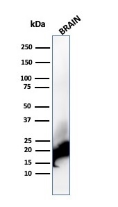 WB analysis of human brain tissue lysate using GTX02673 Myelin basic protein antibody [rMBP/4288].