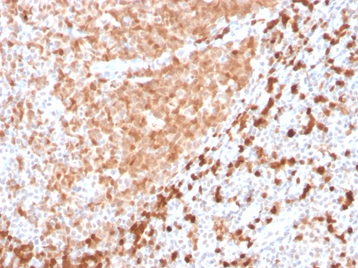 IHC-P analysis of human tonsil tissue section using GTX02676 Mesothelin antibody [TCL1/2747R].