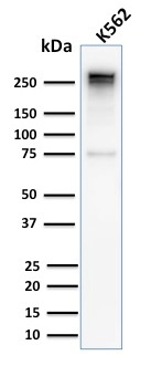 WB analysis of K562 whole cell lysate using GTX02715 alpha 1 Spectrin antibody [SPTA1/2939R].