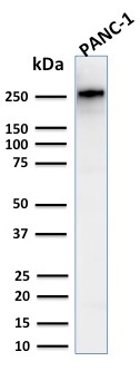 WB analysis of PANC-1 whole cell lysate using GTX02716 SPTBN2 antibody [SPTBN2/2894R].