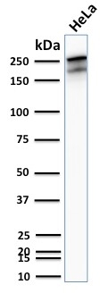WB analysis of HeLa whole cell lysate using GTX02716 SPTBN2 antibody [SPTBN2/2894R].