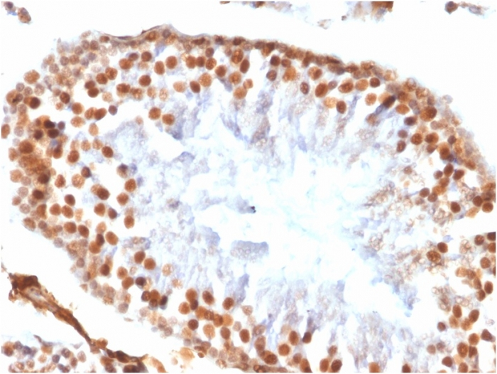 IHC-P analysis of rat testis tissue section using GTX02743 Wilms Tumor 1 antibody [WT1/1434R].