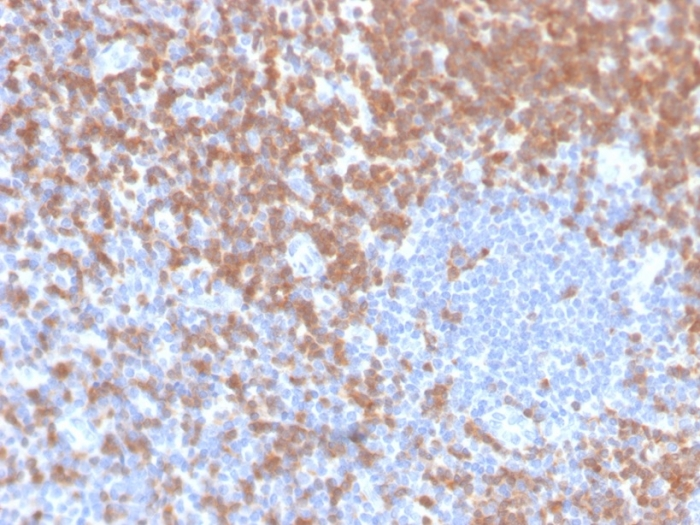 IHC-P analysis of human tonsil tissue section using GTX02746 ZAP70 antibody [ZAP70/4040R].