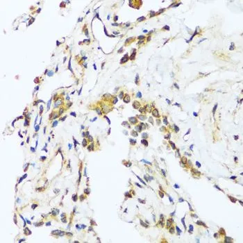 IHC-P analysis of human lung tissue using GTX02777 BAG3 antibody. Dilution : 1:100
