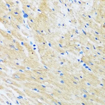IHC-P analysis of rat heart tissue using GTX02777 BAG3 antibody. Dilution : 1:100