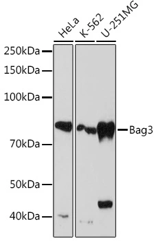 WB analysis of various samples using GTX02778 BAG3 antibody [GT1222]. Dilution : 1:1000 Loading : 25microg per lane