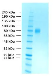 SDS-PAGE of GTX02784-pro Human FGFR2 alpha IIIc (extracellular region) protein. SDS-PAGE of GTX02784-pro Human FGFR2 alpha IIIc (extracellular region) protein.