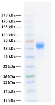 SDS-PAGE of GTX02786-pro Human FGFR3 alpha IIIc (extracellular region) protein. SDS-PAGE of GTX02786-pro Human FGFR3 alpha IIIc (extracellular region) protein.