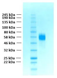SDS-PAGE of GTX02787-pro Human FGFR4 (extracellular region) protein. SDS-PAGE of GTX02787-pro Human FGFR4 (extracellular region) protein.