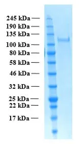 SDS-PAGE of GTX02793-pro Human THSD7A (extracellular region) protein. SDS-PAGE of GTX02793-pro Human THSD7A (extracellular region) protein.