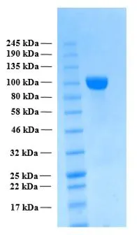 SDS-PAGE of GTX02797-pro Human APP beta (extracellular region) protein. SDS-PAGE of GTX02797-pro Human APP beta (extracellular region) protein.