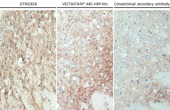 VAMP2 antibody [GT766] detects VAMP2 protein at cell membrane by immunohistochemical analysis. Sample: Paraffin-embedded mouse brain. VAMP2 stained by VAMP2 antibody [GT766] (GTX634829) diluted at 1:500. The signal was developed by OneStep Polymer HRP anti-mouse (Ready-to-Use) (left), VECTASTAIN® ABC-HRP Kits (middle), and conventional secondary antibody (right). Antigen Retrieval: Citrate buffer, pH 6.0, 15 min