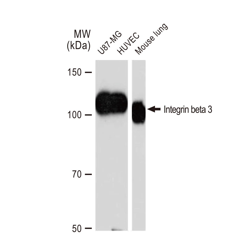 WB analysis of various samples using GTX02823 Integrin beta 3 antibody [GT1226]. Dilution : 1:1000 Loading : 25microg