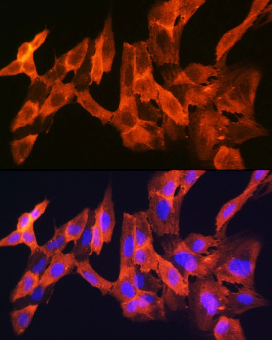 ICC/IF analysis of C6 cells using GTX02824 JNK1 + JNK3 antibody [GT1227]. Dilution : 1:100 Blue : DAPI for nuclear staining.