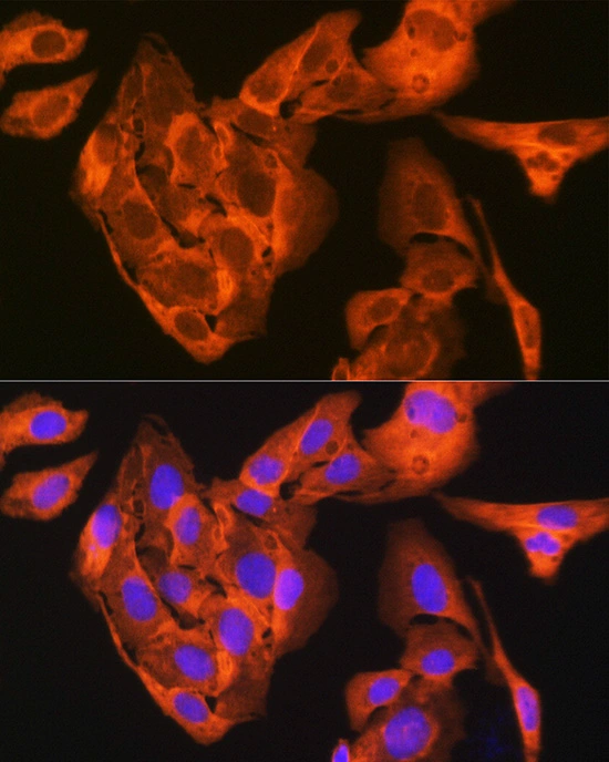 ICC/IF analysis of U2OS cells using GTX02824 JNK1 + JNK3 antibody [GT1227]. Dilution : 1:100 Blue : DAPI for nuclear staining.