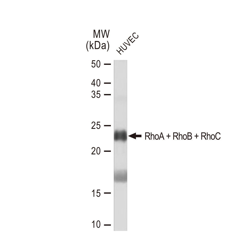 WB analysis of HUVEC whole cell lysate using GTX02825 RhoA + RhoB + RhoC antibody [GT1228]. Dilution : 1:1000 Loading : 25microg