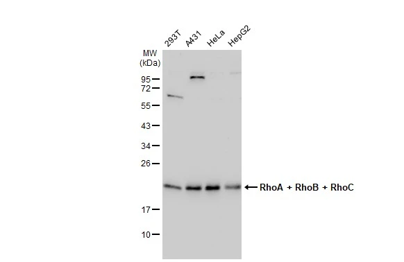 Various whole cell extracts (30 microg) were separated by 12% SDS-PAGE, and the membrane was blotted with RhoA + RhoB + RhoC antibody [GT1228] (GTX02825) diluted at 1:1000. The HRP-conjugated anti-rabbit IgG antibody (GTX213110-01) was used to detect the primary antibody.