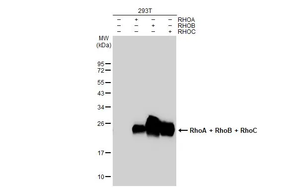 Non-transfected (-) and transfected (+) 293T whole cell extracts (30 microg) were separated by 12% SDS-PAGE, and the membrane was blotted with RhoA + RhoB + RhoC antibody [GT1228] (GTX02825) diluted at 1:100000. The HRP-conjugated anti-rabbit IgG antibody (GTX213110-01) was used to detect the primary antibody.