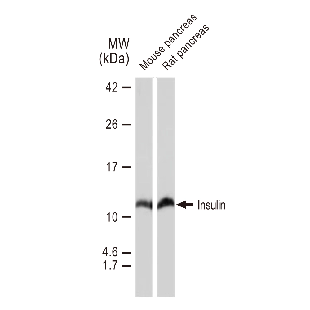 WB analysis of various samples using GTX02826 Insulin antibody [GT1229]. Dilution : 1:1000 Loading : 25microg