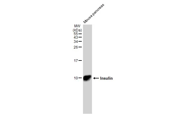 Mouse tissue extract (50 microg) was separated by 15% SDS-PAGE, and the membrane was blotted with Insulin antibody [GT1229] (GTX02826) diluted at 1:1000. The HRP-conjugated anti-rabbit IgG antibody (GTX213110-01) was used to detect the primary antibody.